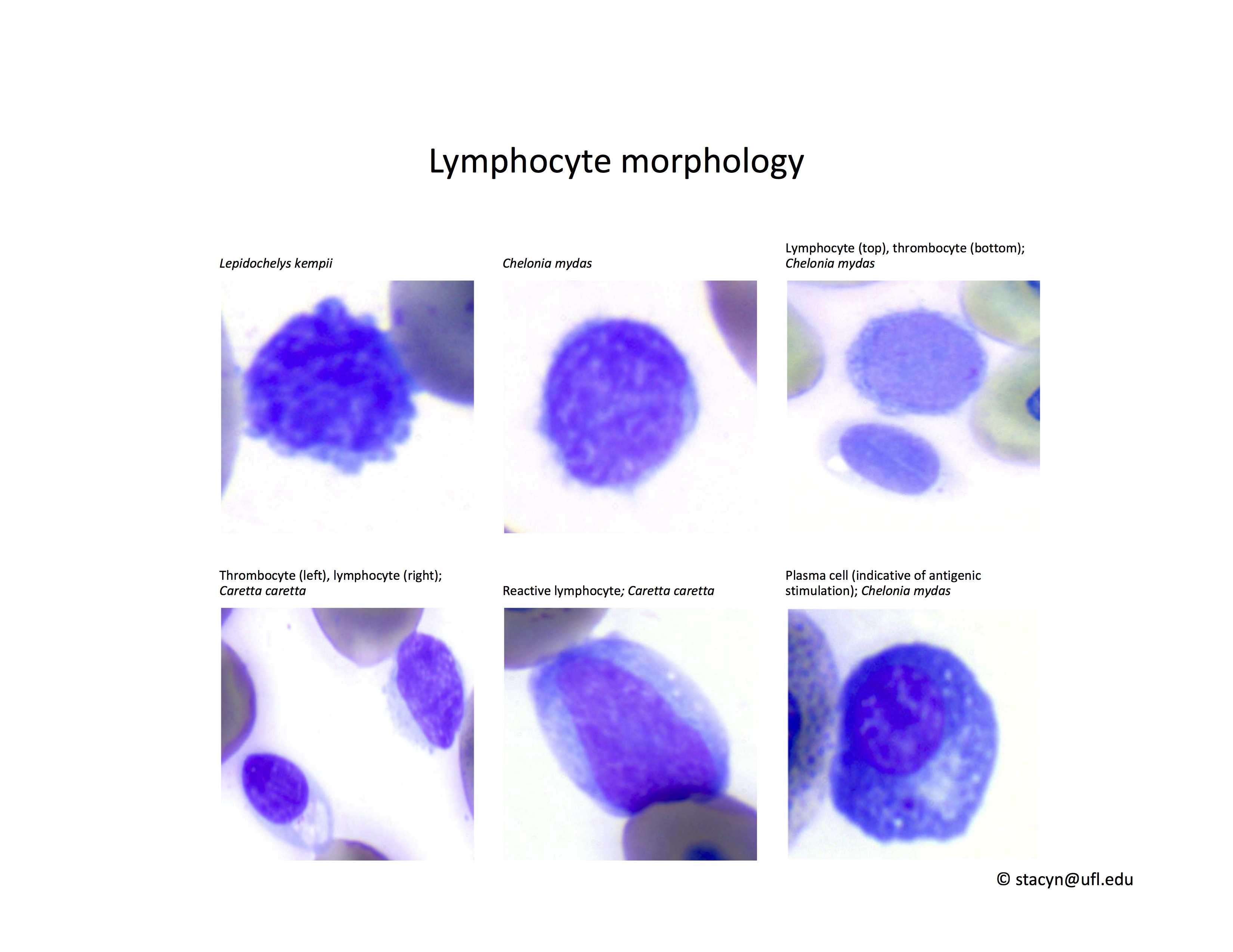 reactive lymphocytes vs monocytes