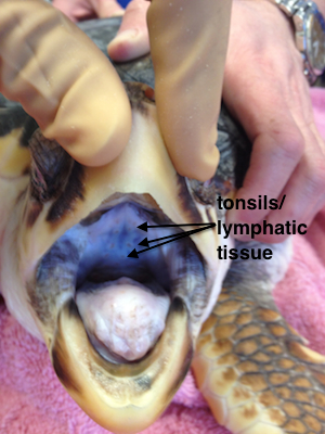 tonsils